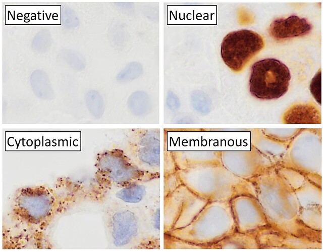 Main_staining_patterns_on_immunohistochemistry